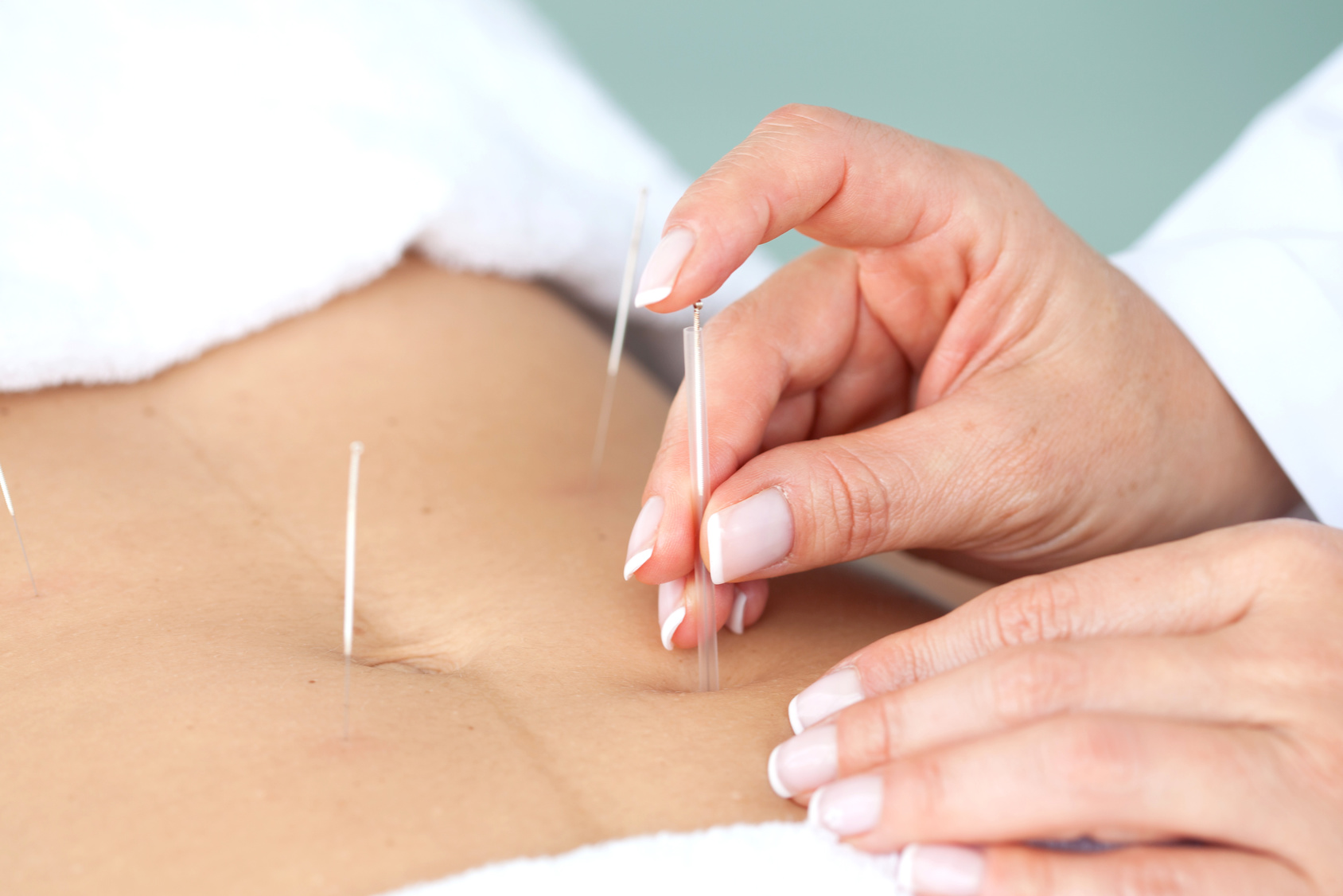 Acupuncture and IVF: Can It Support Your Fertility Journey?