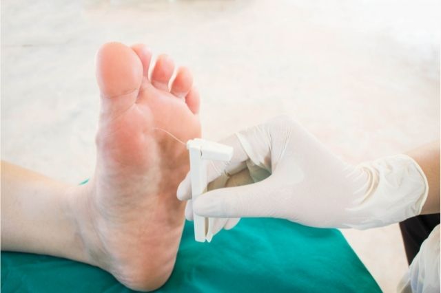 Is acupuncture good for neuropathic pain?